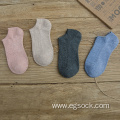 candy color women's no show cotton ankle socks